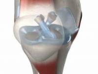 10 étel, amit semmiképpen ne fogyasszon, ha ízületi fájdalomban szenved