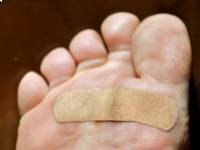 A bőrhorzsolások otthoni kezelése