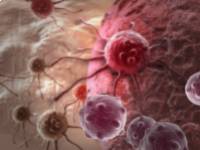 A prosztatarák legfontosabb jelei és tünteti, amikről tudnia kell