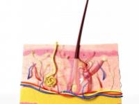 Hogyan kezeljük otthon a begyulladt szőrtüszőt?