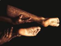 Mi a thrombus? Okok és típusok