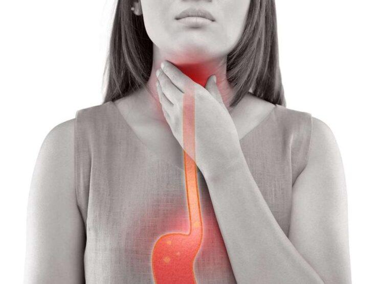 Használhat-e citromos vizet a reflux kezelésére?